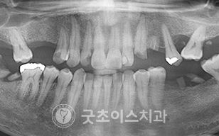 치료전 사진5