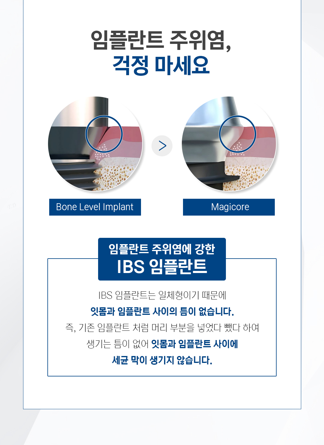 임플란트 주위염, 걱정 마세요